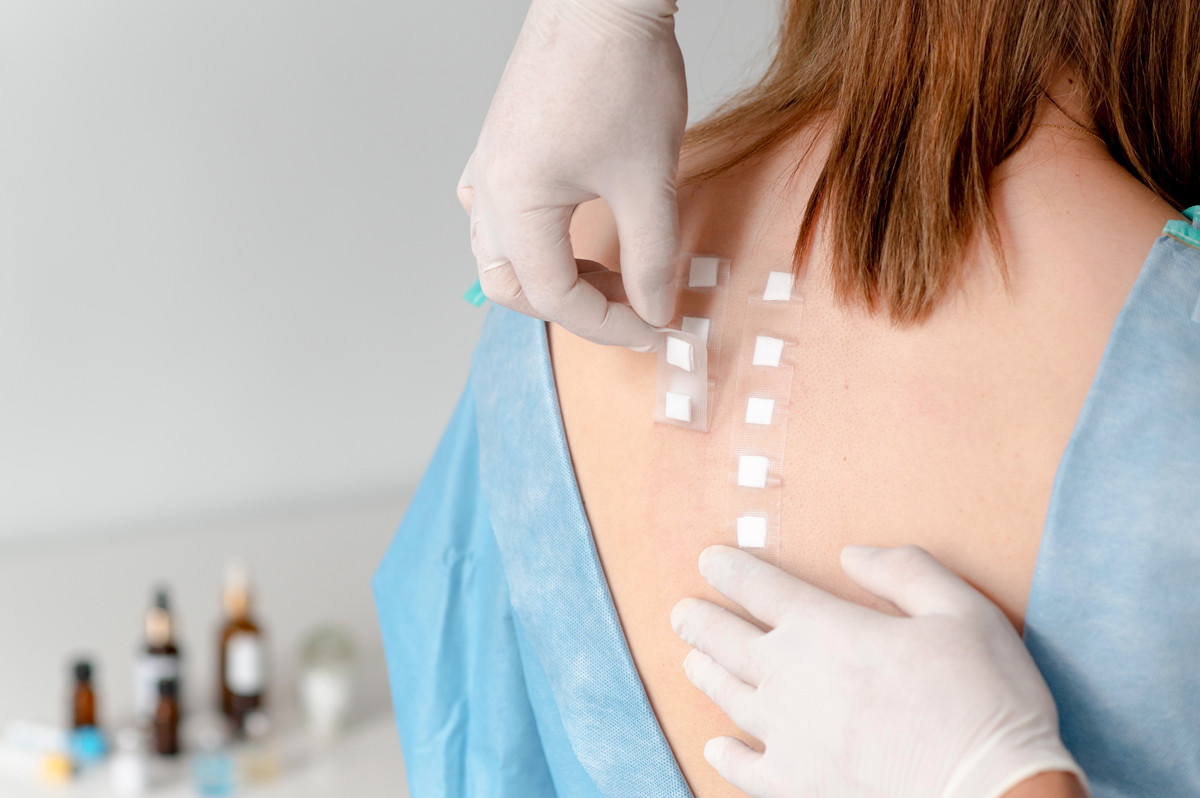 allergy skin test