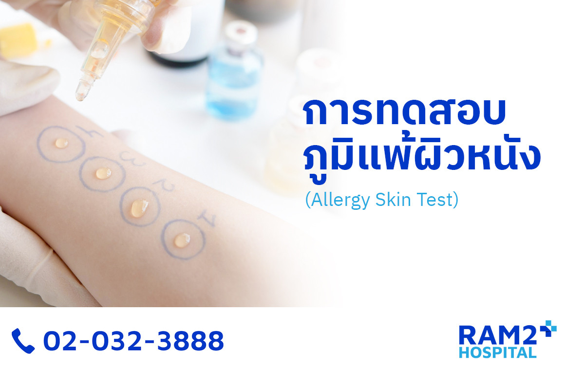 ทดสอบภูมิแพ้ผิวหนัง