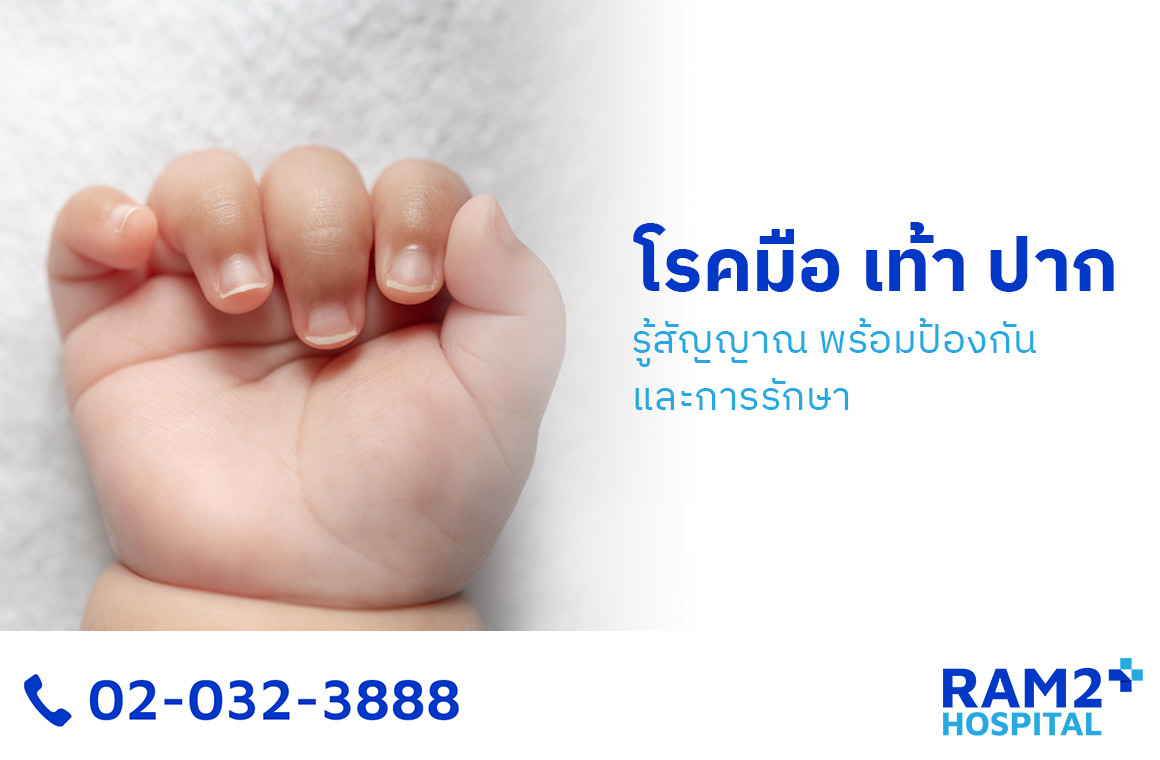 โรคมือ เท้า ปาก