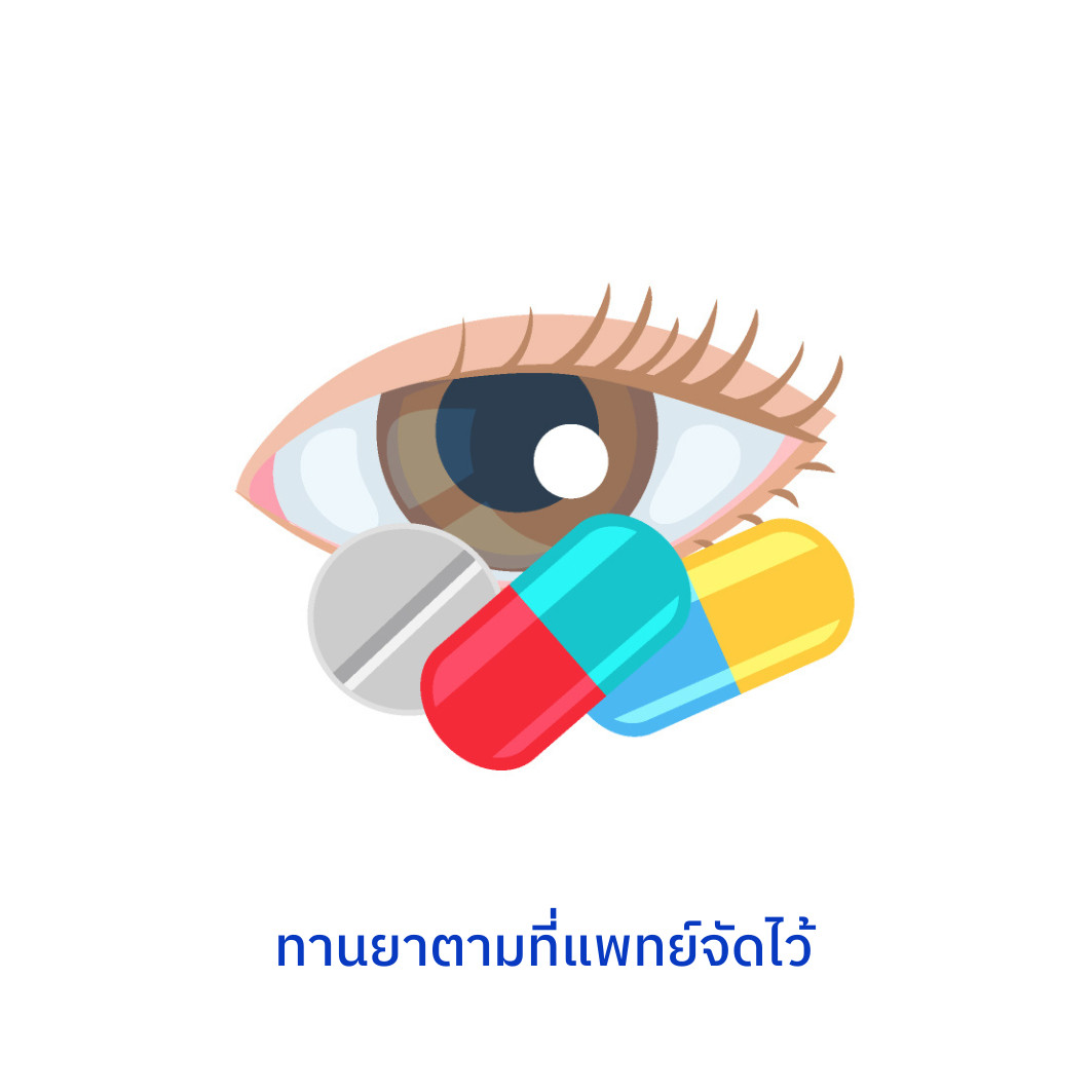 ต้อกระจก