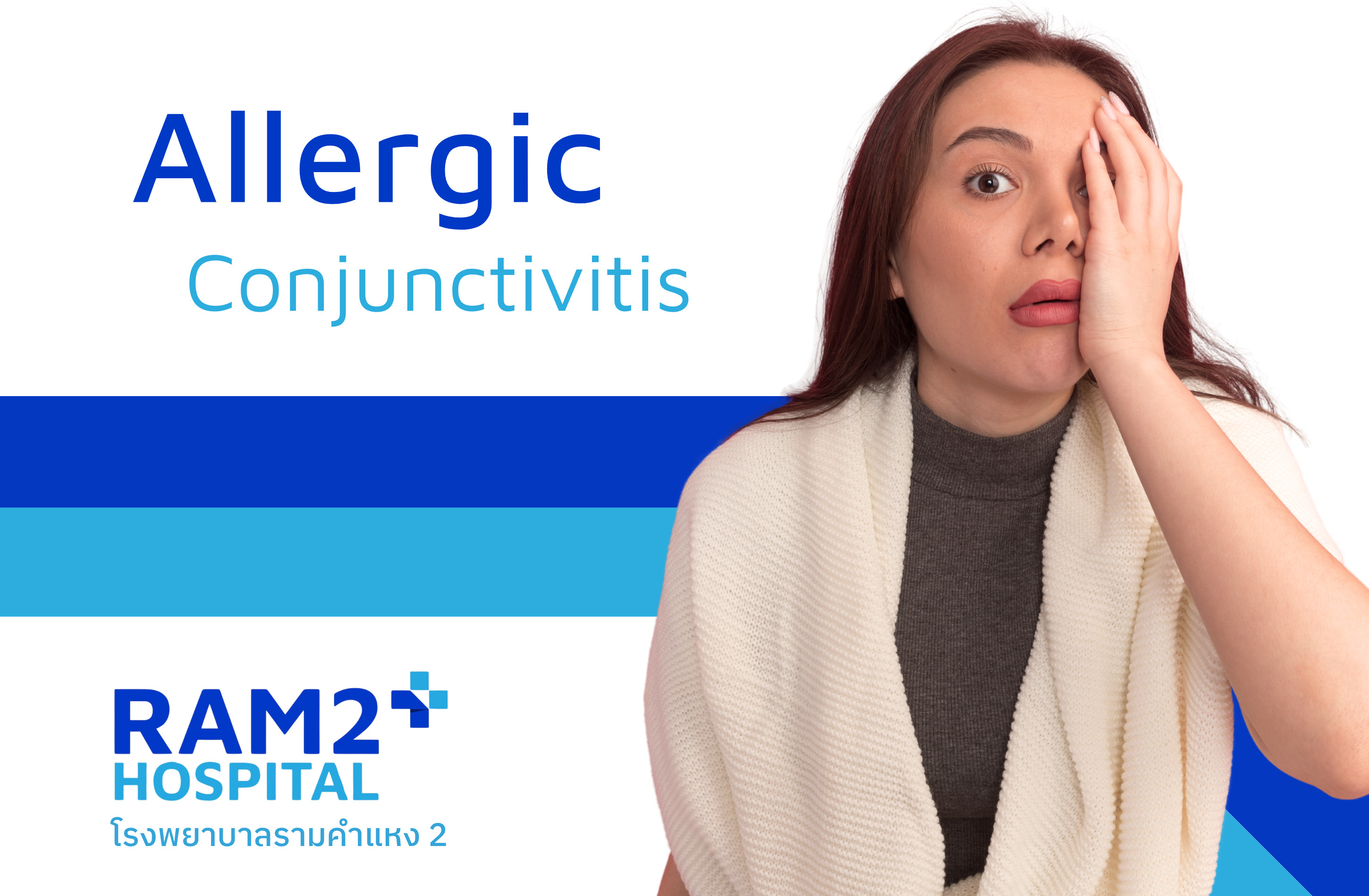 allergic conjunctivitis